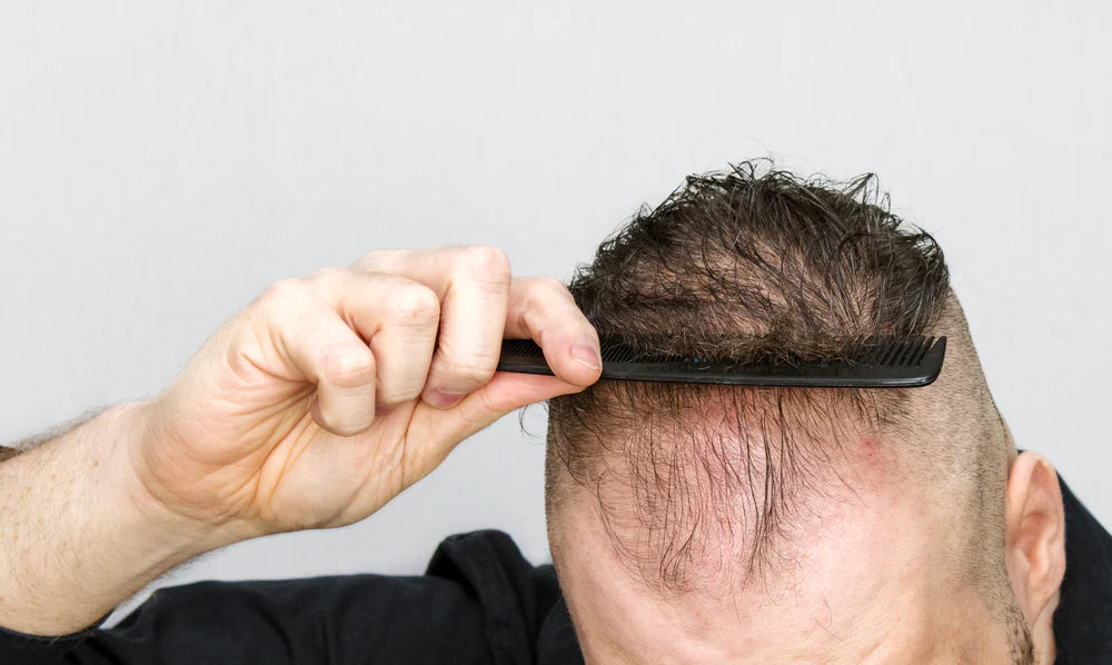 Thinning hair store solutions